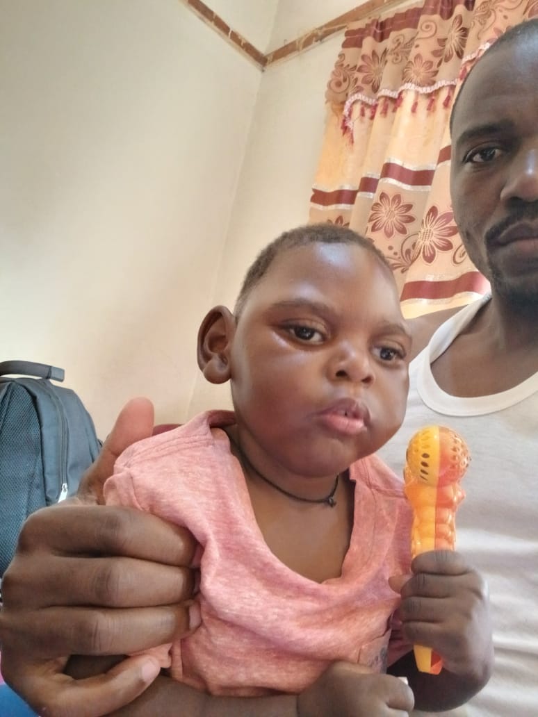 Mother and child living with microcephaly